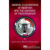 Graphic Illustrations Of Abortion And The Diseases Of Menstruation