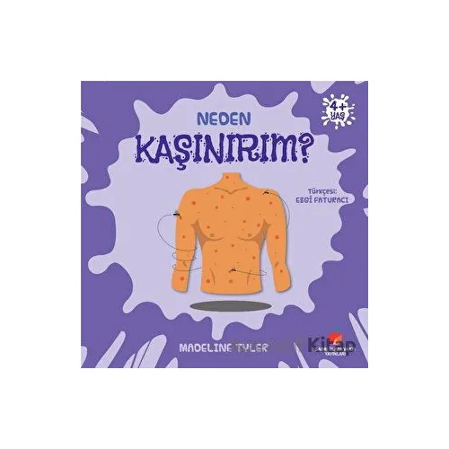 Neden Kaşınırım? - Madeline Tyler - Sabri Ülker Vakfı Yayınları