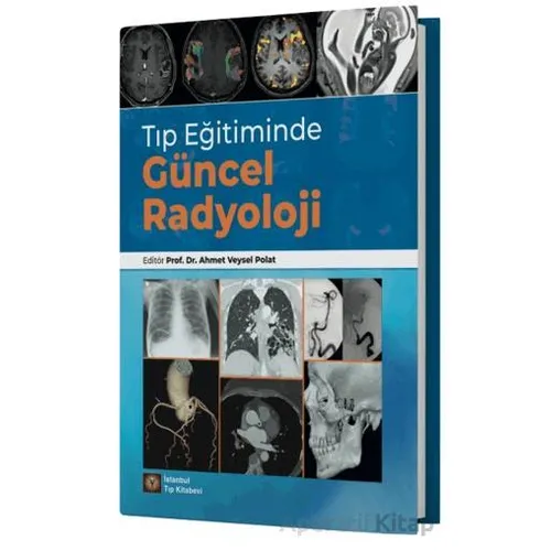 Tıp Eğitiminde Güncel Radyoloji - Ahmet Veysel Polat - İstanbul Tıp Kitabevi